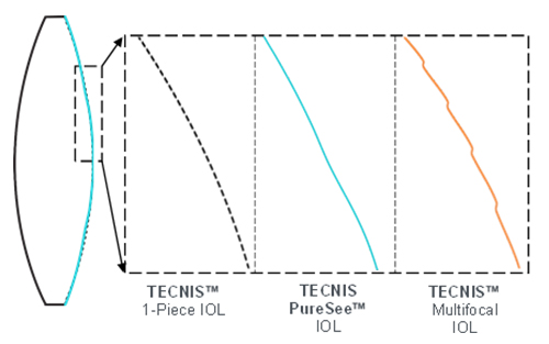 残余屈折に対する高い耐性(TECNIS™ 1-Piece IOL、TECNIS™ Multifocal IOLとTECNIS PureSee™の比較)