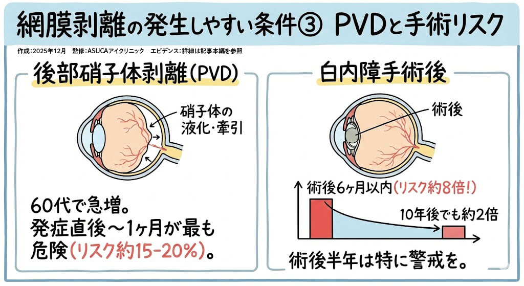 PVDと手術リスク