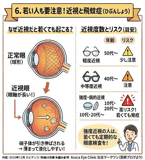 若い人も要注意！近視と飛蚊症